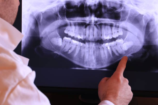 Best Emergency Treatment for Jaw Pain or Injury in Egon City, OR