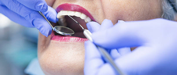 Best Walk-In Emergency Dental Services in Egon City, OR